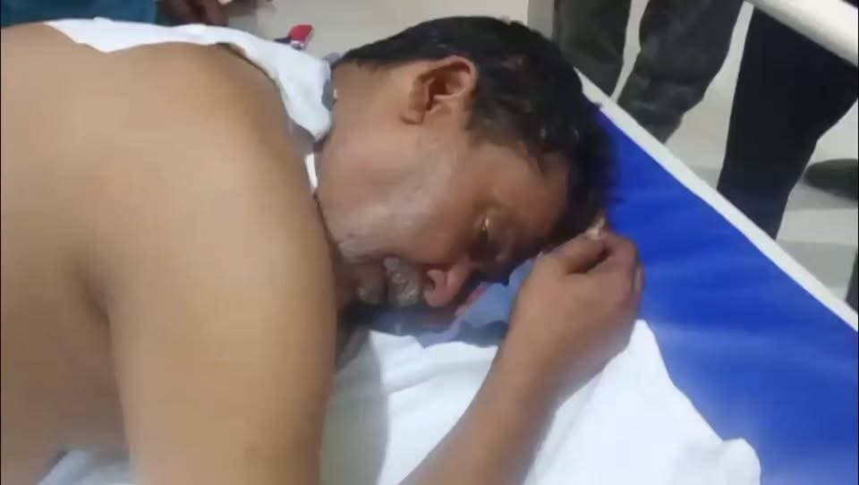 बारिश के पानी को लेकर भाई-भाई में विवाद, चाकूबाजी!
फर्श तोड़कर बारिश का पानी निकालने को लेकर हुआ विवाद
विवाद इतना बढ़ा कि एक भाई ने दूसरे पर चाकू से किए कई वार, पीठ और हाथ पर चाकू लगने से शफात अली गंभीर रूप से घायल शफात अली को अस्पताल में कराया गया भर्ती, कोतवाली नगर क्षेत्र के महाराजगंज इमामबाड़ा का मामला
#Gonda #highlight #KnifeAttack #gondapolice #bharatsamachargonda
