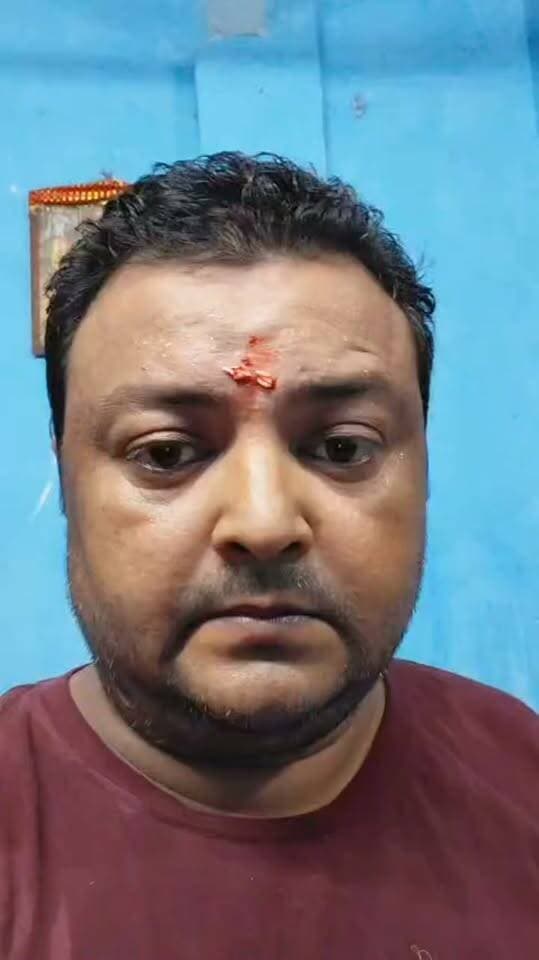 मुंगेर मुख्य बाजार में ठेलों की तेज माइकिंग से लोग परेशान, प्रशासन से कार्रवाई की मांग
मुंगेर प्रशासन से नम्र निवेदन है कि मुख्य बाजार में स्थायी रूप से ठेला लगाकर तेज आवाज में माइकिंग कर सामान बेचने वालों पर कार्रवाई की जाए। पिछले करीब एक वर्ष से स्थानीय निवासी ध्वनि प्रदूषण से बेहद परेशान हैं। बच्चों की पढ़ाई प्रभावित हो रही है, लोग न तो शांति से बातचीत कर पा रहे हैं और न ही आराम कर पा रहे हैं।
स्थायी निवासी नियमित रूप से टैक्स और अन्य दायित्वों का पालन करते हैं, ऐसे में उन्हें शांतिपूर्ण जीवन जीने का अधिकार भी मिलना चाहिए। माइकिंग के साथ सड़क जाम की समस्या भी बढ़ रही है।
प्रशासन से आग्रह है कि ध्वनि प्रदूषण और अतिक्रमण पर समान रूप से कार्रवाई कर मुख्य बाजार के लोगों को राहत दिलाई जाए। यदि समस्या का समाधान नहीं हुआ तो स्थानीय निवासी भी अपने स्तर पर इसका विरोध करने को मजबूर होंगे।
#MungerNews #NewsUpdate #MungerSevaManch #MungerMunicipalCorporation #kotvalithana #MungerDistrict #munger पब्लिक न्यूज़ मुंगेर Prabhat Ranjan Citynews Munger @topfans