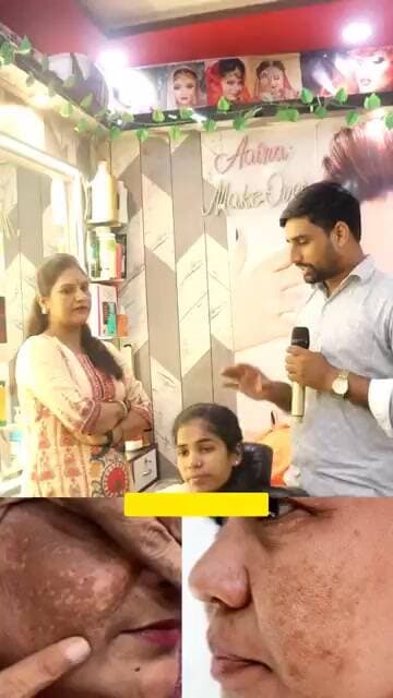 चेहरा पर झांई का घरेलू इलाज #Face #chehra #beautyparlor #beauty