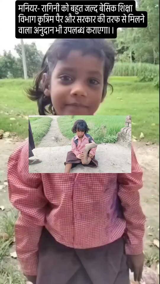 मनियर- रागिनी को बहुत जल्द बेसिक शिक्षा विभाग कृत्रिम पैर और सरकार की तरफ से मिलने वाला अनुदान भी उपलब्ध कराएगा। ।