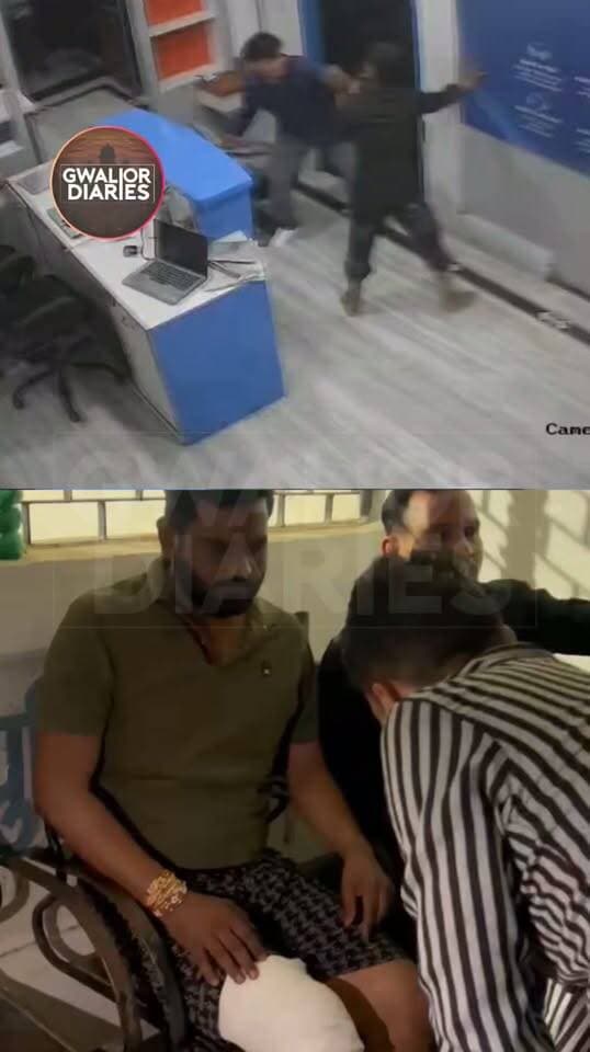 AC इंस्टॉलेशन को लेकर विवाद, सर्विस सेंटर संचालक की टांग तोड़ी; खुद को पूर्व विधायक का भतीजा बताया...