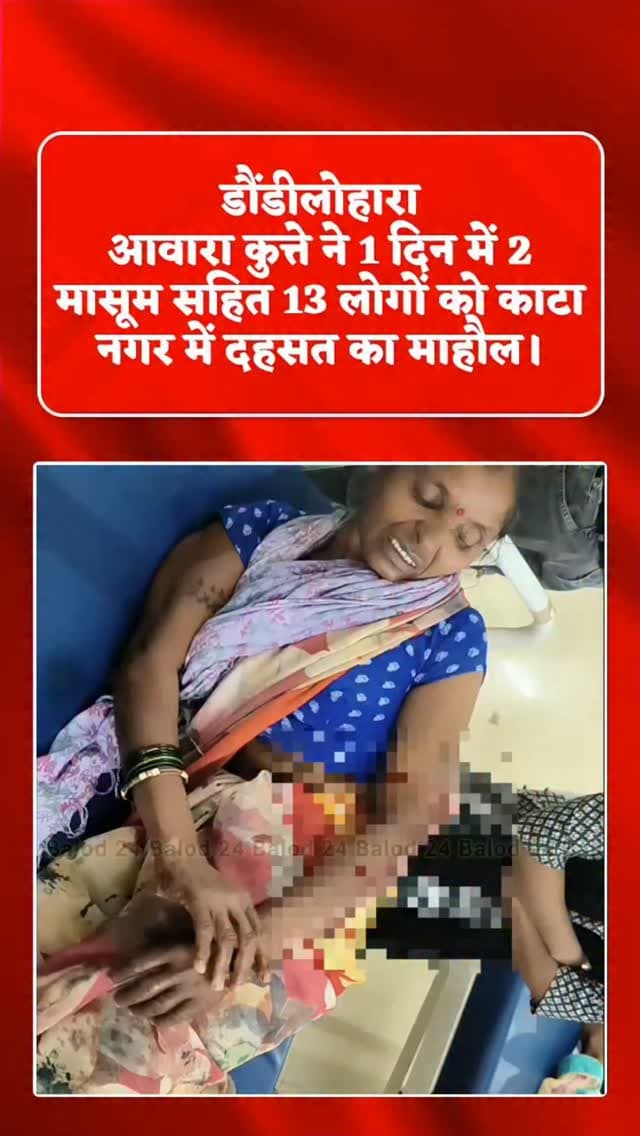 डौंडीलोहारा नगर में आवारा कुत्ते से लोगों में दहशत फैल गई है। नगर के अलग-अलग इलाकों में एक आवारा कुत्ते ने 13 लोगों को अपना शिकार बनाया। कुत्ते के हमले में महिलाएं, बच्चे और बुजुर्ग भी घायल हुए हैं। किसी के पैर तो किसी के हाथ मे कुत्ते ने काटा है। कुछ लोग डौंडीलोहारा के ही हैं तो कुछ लोग बाहर के हैं।
जानकारी के मुताबिक, आवारा कुत्ते ने नगर के अलग-अलग स्थानों पर लोगों पर अचानक हमला कर दिया। कुत्ते के काटने से घायल सभी लोगों को तत्काल डौंडीलोहारा सामुदायिक स्वास्थ्य केंद्र पहुंचाया गया, जहां उनका उपचार जारी है। बताया जा रहा है कि कुत्ते के हमले में घायल 3 लोगों की हालत गंभीर है। चिकित्सकों की निगरानी में उनका इलाज किया जा रहा है। घटना के बाद नगर में लोगों के बीच डर का माहौल है। लोग घरों से निकलने में भी सतर्कता बरत रहे हैं।
#dogbite #dogattack #animals #breakingnews #trending
