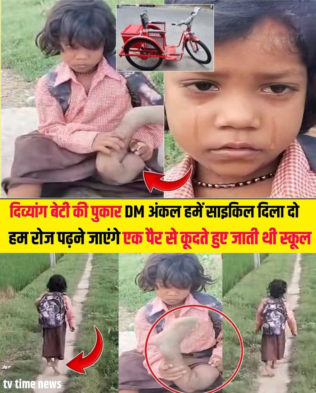 दिव्यांग बेटी ने DM से लगाई गुहार DM अंकल हमें साइकिल दिलवा दो हम रोज स्कूल आएंगे 👏👏
उत्तरप्रदेश बलिया की रहने वाली 07 वर्षीय रागनी की कहानी लोगों के दिल को झकझोर दिया
🌟 एक पैर से 400 मीटर दौड़कर स्कूल जाती थी रागिनी, DM ने बढ़ाया मदद का हाथ
उत्तर प्रदेश के बलिया की 7 वर्षीय रागिनी की हिम्मत और पढ़ाई के प्रति लगन ने हर किसी का दिल जीत लिया। हादसे में एक पैर गंभीर रूप से खराब होने के बावजूद रागिनी ने पढ़ाई नहीं छोड़ी।
रागिनी रोज करीब 400 मीटर तक एक पैर के सहारे स्कूल जाती थी। उसका वीडियो सोशल मीडिया पर वायरल हुआ, जिसमें उसने DM से साइकिल दिलाने की मासूम अपील की थी।
वीडियो सामने आने के बाद जिला प्रशासन ने तुरंत संज्ञान लिया। अधिकारियों और डॉक्टरों ने रागिनी की जांच कराई और DM खुद उसके घर पहुंचे।
प्रशासन की ओर से रागिनी को ट्राईसाइकिल, पढ़ाई और खेलकूद का सामान दिया गया। साथ ही उसके लिए कृत्रिम पैर तैयार कराने की प्रक्रिया भी शुरू कर दी गई है।
रागिनी का सपना डॉक्टर बनने का है। उसकी हिम्मत और पढ़ाई के प्रति लगन सच में प्रेरणा देने वाली है। ❤️
<nis:link nis:type=tag nis:id=beti nis:value=beti nis:enabled=true nis:link/> <nis:link nis:type=tag nis:id=school nis:value=school nis:enabled=true nis:link/> <nis:link nis:type=tag nis:id=uttarpradesh nis:value=UttarPradesh nis:enabled=true nis:link/> <nis:link nis:type=tag nis:id=tricycle nis:value=tricycle nis:enabled=true nis:link/> <nis:link nis:type=tag nis:id=viralpost nis:value=viralpost nis:enabled=true nis:link/>