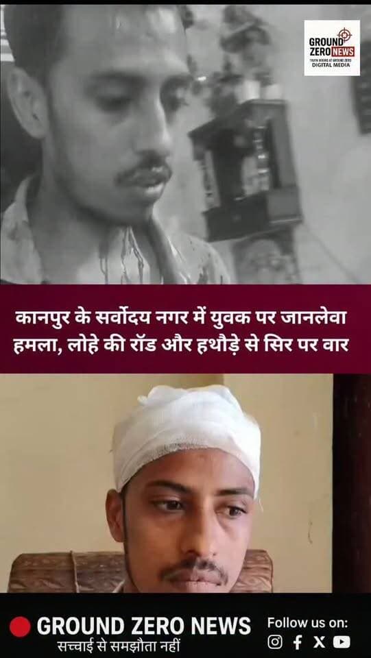 कानपुर के सर्वोदय नगर में 3 सितंबर की रात युवक विपिन कुमार पर कथित जानलेवा हमला किए जाने का मामला सामने आया है। आरोप है कि गाली-गलौज के बाद लोहे की रॉड और हथौड़े से सिर पर वार किया गया, जिससे गंभीर चोट आई और इलाज के दौरान 24 टांके लगाए गए। पीड़ित ने डीसीपी कानपुर नगर को प्रार्थना-पत्र देकर FIR, CCTV जांच और आरोपियों पर सख्त कार्रवाई की मांग की है। मामले की स्वतंत्र पुष्टि नहीं हुई है।
.
.
.
.
.
#groundzeronews
#kanpurnews #breakingnews
#crimenews #uppolice