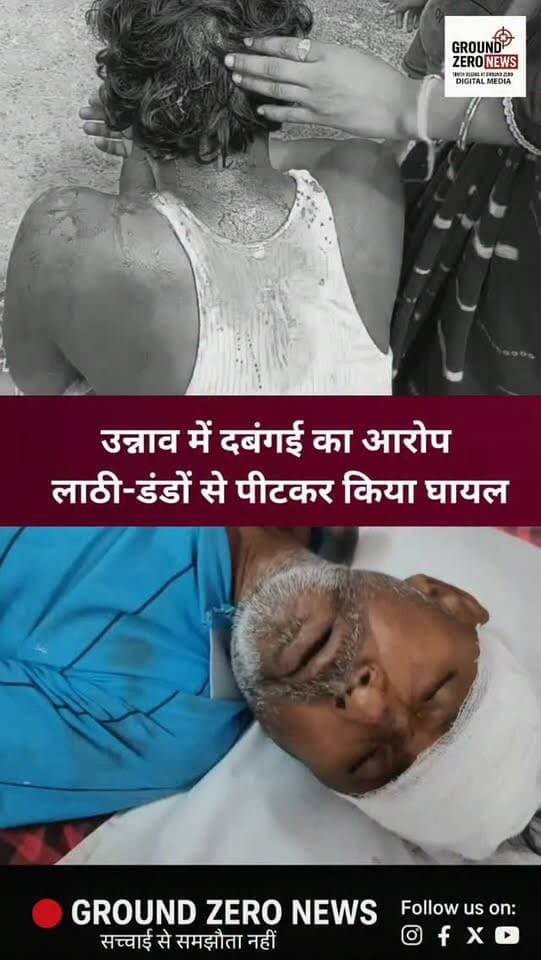 उन्नाव के गंगाघाट थाना क्षेत्र के दादर खेड़ा गांव में मारपीट का मामला सामने आया है। पीड़ित पक्ष का आरोप है कि लाठी-डंडे और फावड़े से किए गए हमले में तीन लोग गंभीर रूप से घायल हुए हैं। दो घायलों का अस्पताल में इलाज चल रहा है। पीड़ित ने पुलिस को प्रार्थना पत्र देकर एक अन्य व्यक्ति का नाम भी मामले में शामिल करने और मेडिकल रिपोर्ट के आधार पर कार्रवाई की मांग की है। पुलिस जांच के बाद ही मामले की पूरी सच्चाई सामने आएगी।
.
.
.
.
.
.
#crimenews #Unnao
#groundzeronews #breakingnews
#uppolice
