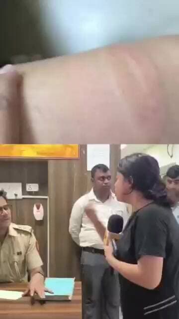 महिला पत्रकार से कथित मारपीट पर सियासी घमासान, पुलिस कार्रवाई पर उठे सवाल