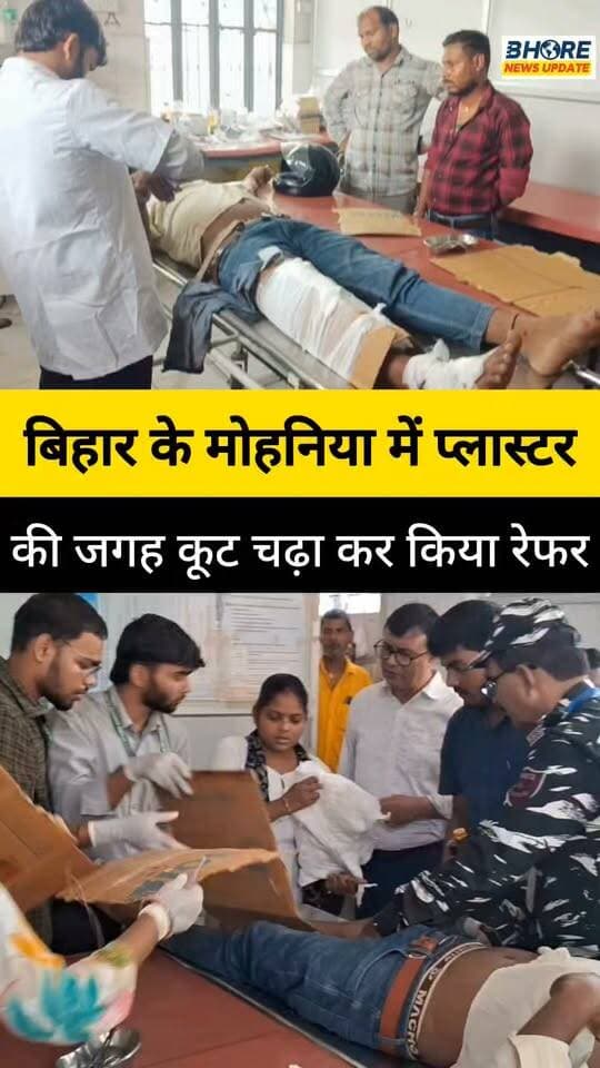 बिहार के मोहनिया में प्लास्टर की जगह पैर में चढ़ा दिया कूट #post #viral #trenfing