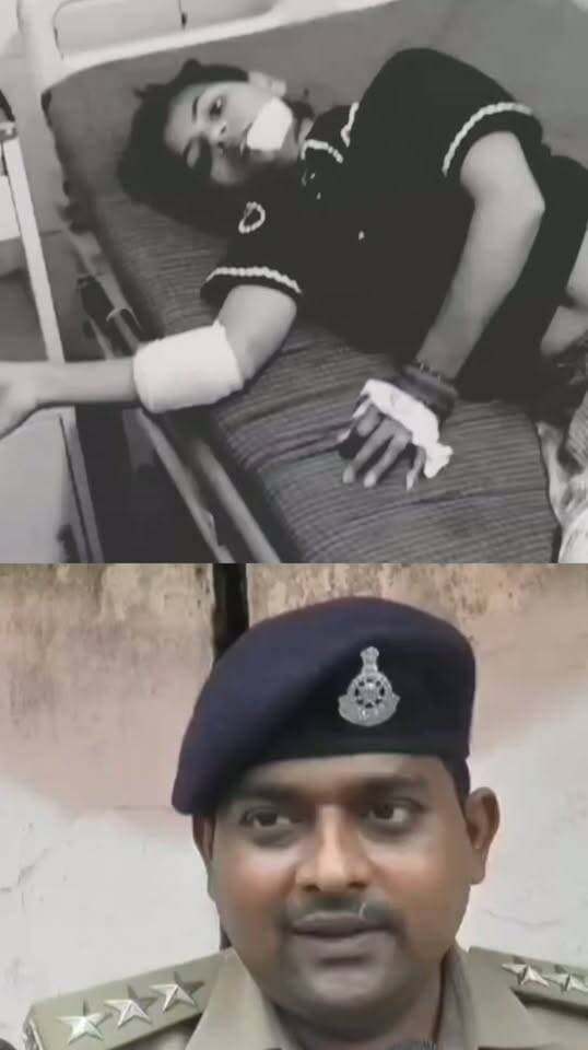 इंस्टाग्राम पर किसी और से बातचीत का शक: पति ने पत्नी के बाल काटे, फिर चाकू से किया जानलेवा हमला...
ग्वालियर के जनकगंज थाना क्षेत्र के बावन पायगा में सोशल मीडिया पर चैटिंग को लेकर पति-पत्नी के बीच विवाद ने हिंसक रूप ले लिया। आरोप है कि इंस्टाग्राम पर किसी दूसरे युवक से बातचीत के शक में विकास पाल ने अपनी पत्नी निशा अहिरवार पर हमला कर दिया। बताया गया कि आरोपी शराब के नशे में मायके पहुंचा, पहले कैंची से पत्नी के बाल काटे और फिर चाकू से कई वार कर उसे गंभीर रूप से घायल कर दिया। चीख-पुकार सुनकर परिजन और पड़ोसी पहुंचे तो आरोपी मौके से भाग निकला। घायल निशा को JAH के ट्रॉमा सेंटर में भर्ती कराया गया, जहां उसकी हालत स्थिर बताई गई है। पुलिस ने आरोपी को हिरासत में लेकर वारदात में इस्तेमाल चाकू बरामद कर लिया है और मामले में कार्रवाई जारी है।