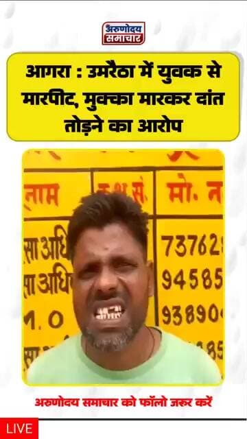 आगरा : उमरैठा में युवक से मारपीट, मुक्का मारकर दांत तोड़ने का आरोप
