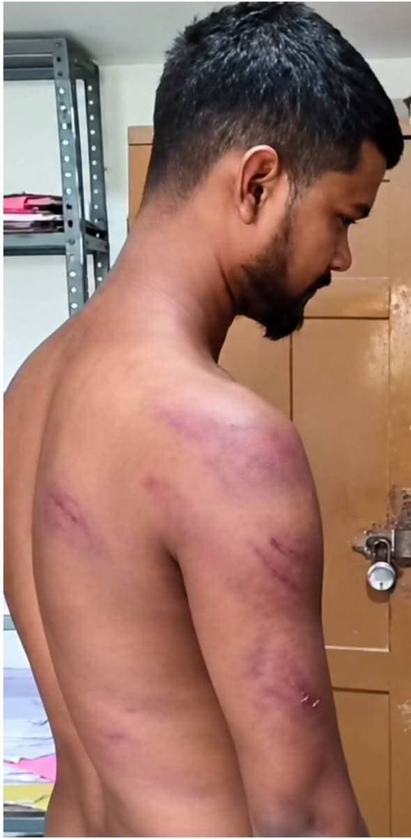 कैमूर में ट्रक चालक से मारपीट का मामला: डीएम ने लिया संज्ञान, जांच समिति गठित, माइनिंग SI का वेतन रोका
कैमूर में खनन विभाग के कर्मियों द्वारा ट्रक चालक के साथ कथित मारपीट के मामले में जिला प्रशासन ने बड़ी कार्रवाई की है। प्रसारित खबर और प्राप्त सूचना को जिला प्रशासन ने अत्यंत गंभीरता से लिया है।
जिलाधिकारी कैमूर द्वारा इस मामले में त्वरित संज्ञान लेते हुए दो बड़े निर्देश जारी किए गए हैं।
पहला - मामले की निष्पक्ष और विस्तृत जांच के लिए अपर समाहर्ता विभागीय जांच तथा जिला खनन पदाधिकारी की दो सदस्यीय संयुक्त जांच समिति का गठन किया गया है। इस समिति को अगले 2 दिनों के भीतर स्थलीय और तथ्यात्मक जांच कर स्पष्ट रिपोर्ट सौंपने का निर्देश दिया गया है।
दूसरा - प्राप्त प्रारंभिक सूचना के आधार पर जांच पूरी होने तक संबंधित खनन सब-इंस्पेक्टर और उस दौरान प्रतिनियुक्त होमगार्ड जवानों का माह सितंबर का वेतन तत्काल प्रभाव से रोक दिया गया है। जांच समिति से क्लियरेंस मिलने के बाद ही वेतन निकासी पर विचार किया जाएगा।
जिला प्रशासन ने स्पष्ट किया है कि कानून हाथ में लेने या पद के दुरुपयोग की किसी भी घटना को बर्दाश्त नहीं किया जाएगा। जांच रिपोर्ट के आधार पर दोषियों के विरुद्ध कठोर अनुशासनात्मक और कानूनी कार्रवाई सुनिश्चित की जाएगी।
