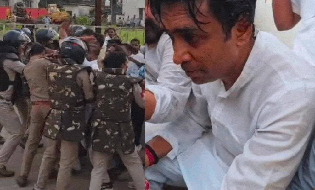*रीवा में कल्पना मिश्रा मौत मामले में बवाल कांग्रेस के प्रदर्शन के दौरान पुलिस से झड़प, बैरिकेड तोड़ने पर पुलिस ने छोड़े आंसू गैस के गोले, झाबुआ विधायक विक्रांत भूरिया की आंख में चोट*
*उप मुख्यमंत्री के आवास की ओर जा रहे थे सैकड़ों कार्यकर्ता, धक्का-मुक्की और झूमाझटकी के बाद बिगड़े हालात, विक्रांत भूरिया का आरोप - पुलिस ने आंख में मारा डंडा, फोड़ने की कोशिश की, पिता की 9वें दिन अनशन पर बिगड़ी हालत, PCC चीफ जीतू पटवारी ने की मुलाकात*
रीवा। शहर के अग्रसेन चौराहे पर पिछले 5 दिनों से कल्पना मिश्रा की मौत के मामले में चल रहा कांग्रेस का न्याय सत्याग्रह गुरुवार को हिंसक झड़प में बदल गया। गुरुवार को धरना स्थल से सैकड़ों कांग्रेस कार्यकर्ता और नेता सिरमौर चौराहे की ओर कूच कर रहे थे, जहां कल्पना मिश्रा के पिता पिछले 9 दिनों से कार्रवाई और न्याय की मांग को लेकर आमरण अनशन पर बैठे हैं। इसी दौरान रास्ते में पुलिस और कार्यकर्ताओं के बीच जमकर धक्का-मुक्की, झूमाझटकी और झड़प हो गई।
*बैरिकेड तोड़ने की कोशिश पर पुलिस ने छोड़े आंसू गैस के गोले*
पुलिस के मुताबिक कांग्रेस कार्यकर्ता जब बैरिकेडिंग के पास पहुंचे तो उन्होंने बैरिकेड तोड़कर आगे बढ़ने की कोशिश की। पुलिस ने उन्हें रोकने का प्रयास किया, जिस पर दोनों पक्षों के बीच तीखी नोकझोंक और धक्का-मुक्की शुरू हो गई। देखते ही देखते स्थिति बिगड़ने लगी और भीड़ को नियंत्रित करने के लिए पुलिस को आंसू गैस के गोले छोड़ने पड़े। आंसू गैस छोड़ते ही मौके पर अफरा-तफरी मच गई। इस झड़प में आदिवासी कांग्रेस के राष्ट्रीय अध्यक्ष और झाबुआ विधायक डॉ. विक्रांत भूरिया की आंख में गंभीर चोट आई है। घायल अवस्था में उन्होंने पुलिस पर गंभीर आरोप लगाए हैं। विक्रांत भूरिया ने कहा कि "मैं लगातार मना करता रहा, लेकिन पुलिस ने मेरी आंख में डंडे से मारा। मेरी आंख फोड़ने की कोशिश की गई।" इस घटना के बाद कांग्रेस कार्यकर्ताओं में और अधिक आक्रोश फैल गया।
*9वें दिन पिता की हालत बिगड़ी, लेटकर कर रहे अनशन*
उधर सिरमौर चौराहे पर कल्पना मिश्रा के पिता का आमरण अनशन गुरुवार को 9वें दिन भी जारी रहा, लेकिन अब उनकी हालत बेहद नाजुक बनी हुई है। परिजनों के मुताबिक लगातार भूख हड़ताल के कारण उनके शरीर में अत्यधिक कमजोरी आ गई है। अब वे ठीक से बैठ भी नहीं पा रहे हैं और लेटकर ही अनशन कर रहे हैं। उनकी हालत इतनी खराब हो चुकी है कि वे ठीक से बातचीत भी नहीं कर पा रहे हैं। परिजनों ने स्पष्ट कहा है कि जब तक बेटी कल्पना को न्याय नहीं मिलता और मामले में जिम्मेदार डॉक्टरों व लोगों पर कड़ी कार्रवाई नहीं होती, तब तक पिता का अनशन जारी रहेगा, चाहे उनकी जान ही क्यों न चली जाए।
*जीतू पटवारी ने की पिता से मुलाकात, विधानसभा में उठाने का ऐलान*
कांग्रेस के इस प्रदर्शन को समर्थन देने गुरुवार को प्रदेश कांग्रेस अध्यक्ष जीतू पटवारी रीवा पहुंचे। वे पहले अग्रसेन चौराहे पर चल रहे कांग्रेस के धरना स्थल पर पहुंचे और कार्यकर्ताओं को संबोधित किया। इसके बाद वे सीधे सिरमौर चौराहे पर पहुंचे, जहां उन्होंने अनशन पर बैठे कल्पना मिश्रा के पिता से मुलाकात की और उनके स्वास्थ्य की जानकारी ली। पुलिस और कांग्रेस कार्यकर्ताओं के बीच हुई झड़प के बाद जीतू पटवारी ने सरकार पर जमकर हमला बोला। उन्होंने कहा कि कल्पना मिश्रा के मामले को कांग्रेस के सभी विधायक विधानसभा में प्रमुखता से उठाएंगे। उन्होंने कहा कि कांग्रेस का एक प्रतिनिधिमंडल राज्यपाल और मुख्य सचिव से भी मुलाकात कर पूरे मामले की निष्पक्ष जांच और कार्रवाई की मांग करेगा। उन्होंने कहा कि जब तक रीवा की स्वास्थ्य व्यवस्था में सुधार नहीं होता और कल्पना मिश्रा को न्याय नहीं मिलता, तब तक कांग्रेस का यह आंदोलन जारी रहेगा।