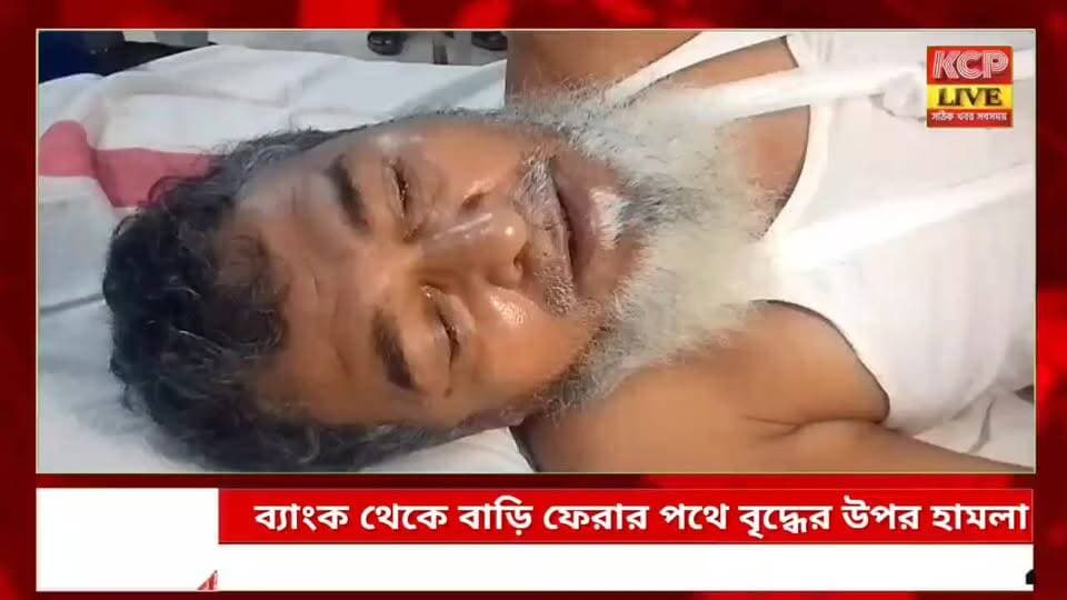 জমি সংক্রান্ত বিবাদের জেরেই ব্যাংক থেকে বাড়ি ফেরার পথে বৃদ্ধের উপর হামলা ।।
জমি সংক্রান্ত বিবাদকে কেন্দ্র করে ৬৬ বছরের এক বৃদ্ধের উপর দা, লাঠি ও রড নিয়ে হামলার অভিযোগ উঠেছে তাঁরই নিকট আত্মীয়দের বিরুদ্ধে। শুক্রবার ঘটনাটি ঘটেছে উত্তর ত্রিপুরা জেলার কদমতলা থানাধীন লক্ষীনগর ২ নম্বর ওয়ার্ড এলাকায়। আহত বৃদ্ধের নাম আপ্তার আলী।পরিবার ও অভিযোগকারীর দাবি, শুক্রবার ব্যাংক থেকে টাকা তুলে বাড়ি ফিরছিলেন আপ্তার আলী। পথে তাঁকে আটকিয়ে জমি সংক্রান্ত পুরনো বিবাদের জেরে আনোয়ার হোসেন, জয়নাল আলী, আব্দুর রহমান, মইনুদ্দিন-সহ কয়েকজন তাঁর উপর চড়াও হন। অভিযুক্তরা দা, লাঠি ও রড দিয়ে হামলা চালান বলে অভিযোগ। আচমকা হামলায় গুরুতর আহত হন ওই বৃদ্ধ।ঘটনার পর স্থানীয়দের সহায়তায় আহত আপ্তার আলীকে কদমতলা হাসপাতালে নিয়ে যাওয়া হয়। সেখানে প্রাথমিক চিকিৎসার পর তাঁর শারীরিক অবস্থার কথা বিবেচনা করে চিকিৎসকরা তাঁকে ধর্মনগর জেলা হাসপাতালে রেফার করেন। বর্তমানে তিনি সেখানে চিকিৎসাধীন বলে পরিবারের পক্ষ থেকে জানানো হয়েছে।এ ঘটনায় ন্যায়বিচারের দাবিতে কদমতলা থানায় লিখিত অভিযোগ দায়ের করেছে পরিবার। অভিযোগের ভিত্তিতে পুলিশ তদন্ত শুরু করেছে।তবে হামলার প্রকৃত কারণ, ঘটনাস্থলে কারা উপস্থিত ছিলেন এবং অভিযোগের সত্যতা কতটা—তা তদন্তের পরই স্পষ্ট হবে। অভিযুক্তদের বিরুদ্ধে পুলিশ কী আইনানুগ ব্যবস্থা নেয়, এখন সেদিকেই নজর এলাকাবাসীর।
#dharmanagar #kanchanpur #panisagar #Kadamtala #kailashahar #churaibari #BreakingNews #khowai #agartala #tripura