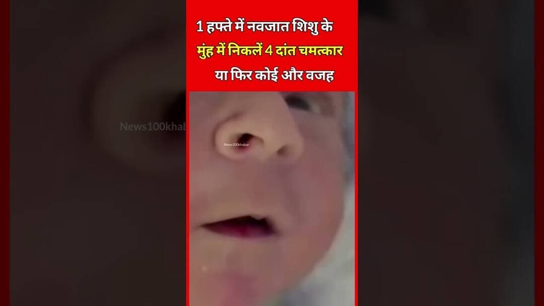 नवजात शिशु के मुंह में निकलें दांत,😳#teeth #children #navjatshishu #baccha #hospital #horror #video