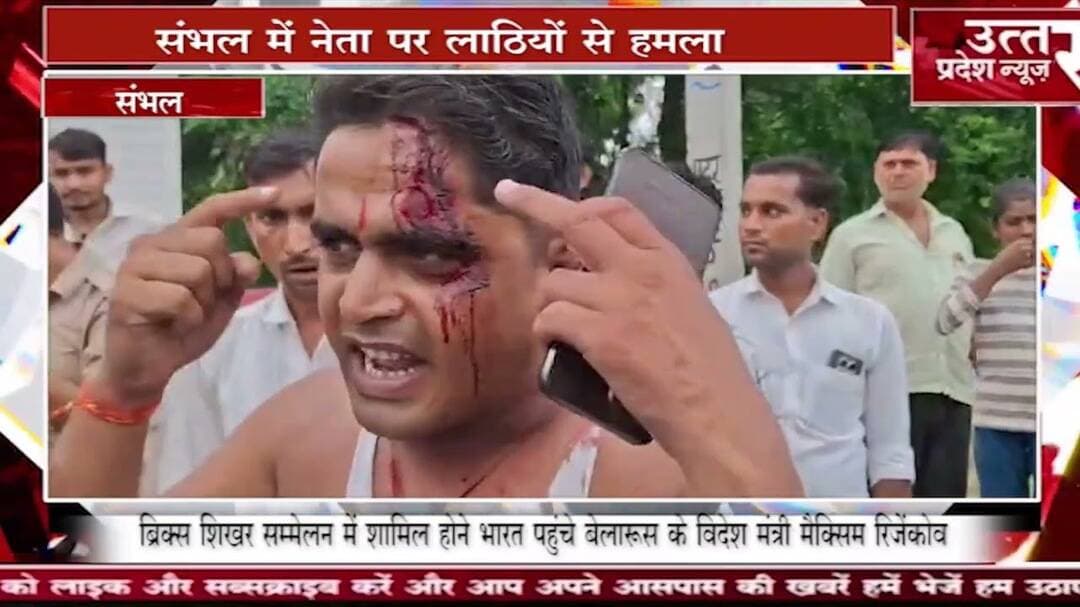 संभल में Rss नेता पर लाठियों से हमला,रास्ता रोक कर हमले का आरोप