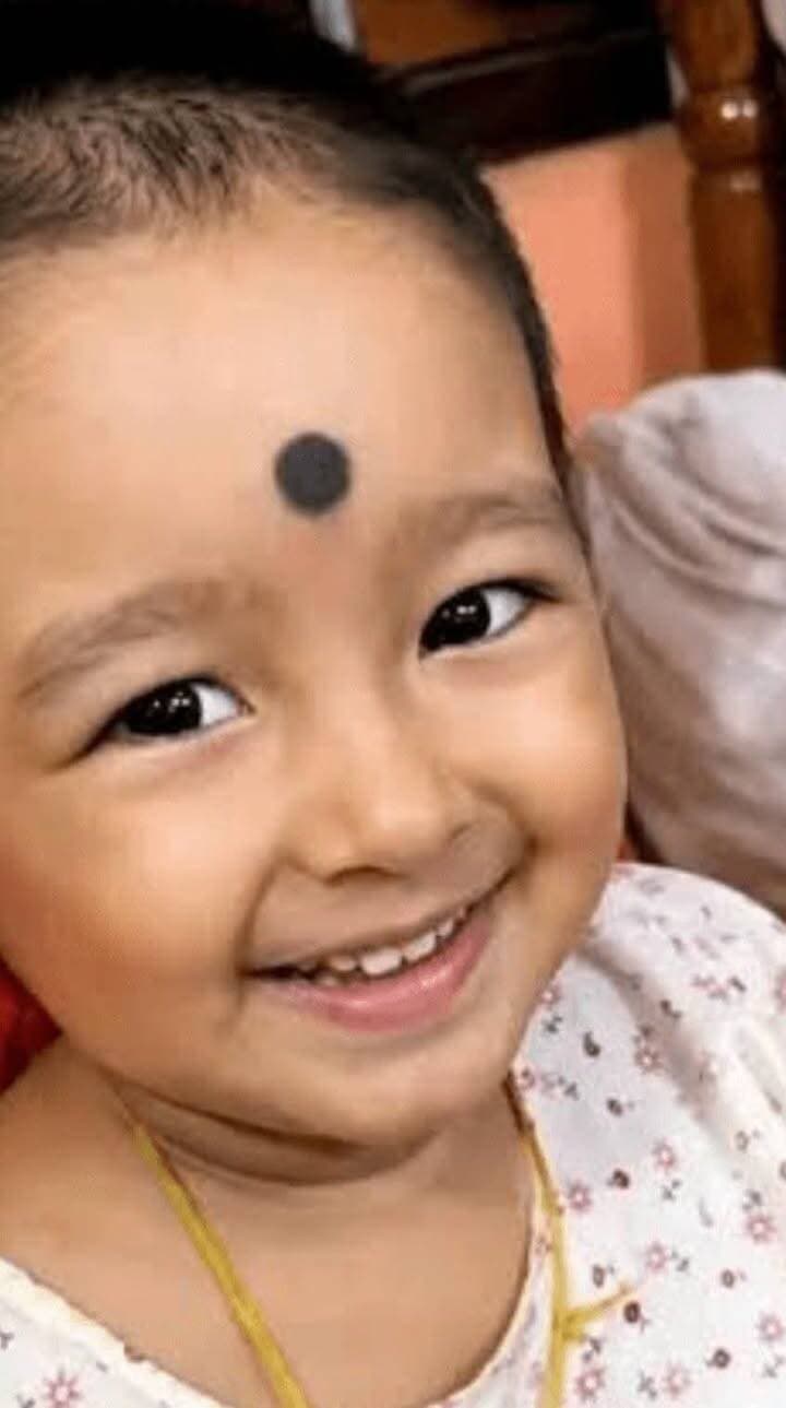 #BreakingNews ।।মনোশ্রী চৌধুরীর চিকিৎসার নামে কি কোটি কোটি টাকা আ*ত্মসা*ৎ? সামনে এলো বড় তথ্য ।
ডেস্ক রিপোর্টার, ১৩ সেপ্টেম্বর।।
শিশু কন্যা মনোশ্রী চৌধুরীর চিকিৎসার নামে কোটি কোটি আর্থিক কে*লে*ঙ্কা*রি! এই কে*লে*ঙ্কা*রি*র তথ্য সামনে নিয়ে এসেছে খোদ রাজ্য স্বাস্থ্য দফতর। মনোশ্রী চৌধুরী এসএমএ (স্পাইনাল মাসকুলার অ্যাট্রোফি) টাইপ ১ নামক একটি জেনেটিক রোগে আক্রান্ত হয়েছিলো। দেশের অর্থ মন্ত্রক মনোশ্রী চৌধুরীর চিকিৎসার জন্য ৫০ লক্ষ টাকা বরাদ্দ করেছিল। রাজ্য স্বাস্থ্য দপ্তরের অনুরোধে টাটা ট্রাস্ট শিশুটির চিকিৎসার জন্য ২০ লক্ষ টাকা প্রদান করেছিলো। এছাড়াও রাজ্য ও বহিঃ রাজ্যের বহু মানুষ দুই হাত ভরে মনোশ্রীর চিকিৎসার জন্য টাকা দিয়েছে। তথ্য অনুযায়ী, এই টাকার পরিমাণ ১০ কোটি টাকারও অধিক।আসাম মেডিকেল কলেজ অ্যান্ড হসপিটাল (ডিব্রুগড়) মনোশ্রী চৌধুরীর চিকিৎসা হয়। এই চিকিৎসা ক্ষেত্রে খরচ হয় মাত্র ২.২৯ লক্ষ টাকা।ডিব্রুগড়ের সেন্টার অফ এক্সিলেন্স মনোশ্রীকে ঔষধ সরবরাহ করেছিল। তারাই রাজ্য স্বাস্থ্য দফতরের হাতে তুলে দিয়েছে মনোশ্রীর চিকিৎসার মোট খরচের টাকার অঙ্ক। মনোশ্রীর একটি " ইনজেকশনে"র (জোলগেনসমা' -Zolgensma) কথা বলে সাধারণ মানুষের কাছ থেকে কোটি কোটি টাকা সংগ্রহ করেছিলেন মনোশ্রীর মা - বাবা সহ শহরের গ্র্যান্ডডিওজ এলাকার বাসিন্দা রাজা সাহা। চিকিৎসকরা জানিয়েছেন, " এই ইনজেকশন এখন মনোশ্রীর জন্য প্রয়োজন নেই"। প্রশ্ন উঠছে কিসের ভিত্তিতে, কার পকেট ভরাট করতে সাধারণ মানুষের " মানবিক" মুখ গুলিকে নিয়ে ছেলে খেলা করা হয়েছে। রাজ্য সরকার কি তার একটা বিহিত করবে। মনোশ্রীর নামে সাধারণ মানুষের কাছ থেকে কত টাকা সংগ্রহ করেছে মনোশ্রীর মা - বাবা রাজা সাহা? রহস্য উন্মোচন করতে প্রয়োজন উচ্চ পর্যায়ের তদন্ত।( আসছে বিস্তারিত...)#tripura#agt#child#manoshree #chowdhury#treatment# health #Department