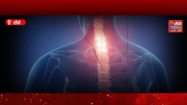 कमर-गर्दन दर्द को हल्के में न लें ! Spine Specialist Dr. Nishant Kumar ने बताई जरूरी बातें ! Ranchi
#DrNishantKumar #SpineSpecialist #SpineHealth #BackPain #NeckPain