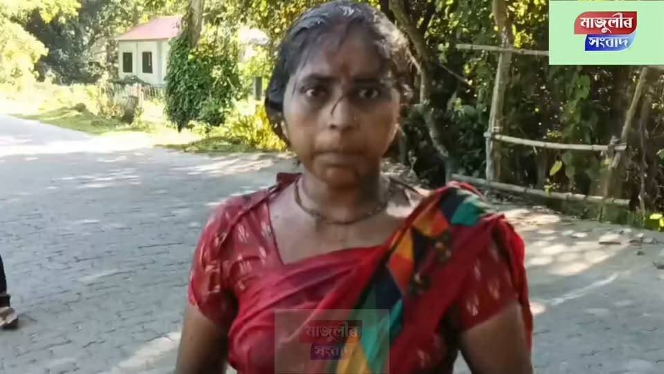 📌কমলাবাৰীত কি দৰে সংঘটিত হৈছিল ই-ৰিস্কাৰ দূ*ৰ্ঘ*ট*না ---
📌কোনোমতে প্ৰা*ণ ৰক্ষা হোৱা মহিলাই কি কয়--- -
উৎপল বৰুৱাৰ সহযোগত নিউজ ডেস্ক, মাজুলীৰ সংবাদ
#NewsUpdate
#hilight