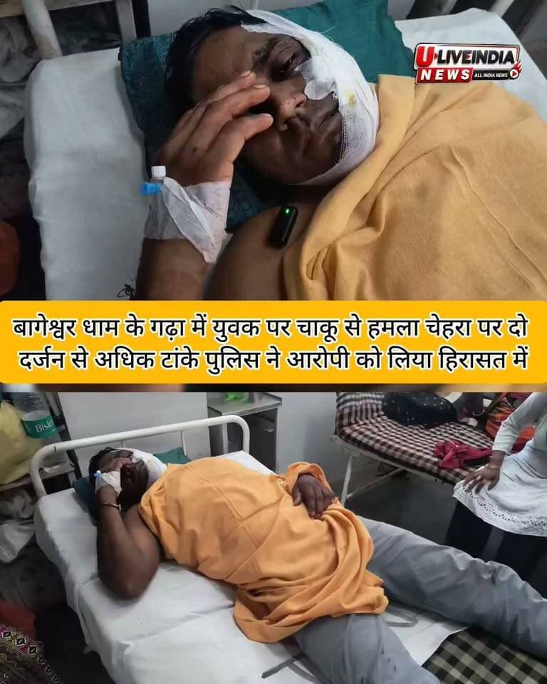 छतरपुर ब्रेकिंग,
बागेश्वर धाम के गांव गढ़ा में चाकूबाज़ी, एक युवक गंभीर रूप से घायल, चेहरा और गर्दन पर कई चाकू मारे, बुरी तरह चेहरे पर 2 दर्जन टांके लगाने पड़े, आरोपी और पीड़ित दोनो सोनीपत हरियाणा के रहने वाले है, बागेश्वर धाम इलाके में होटल का व्यापार करते है।, आपसी विवाद को लेकर हुई घटना,
पुलिस ने आरोपी को पकड़ा,
बमीठा थानाक्षेत्र के बागेश्वर धाम परिसर की बीती रात की घटना