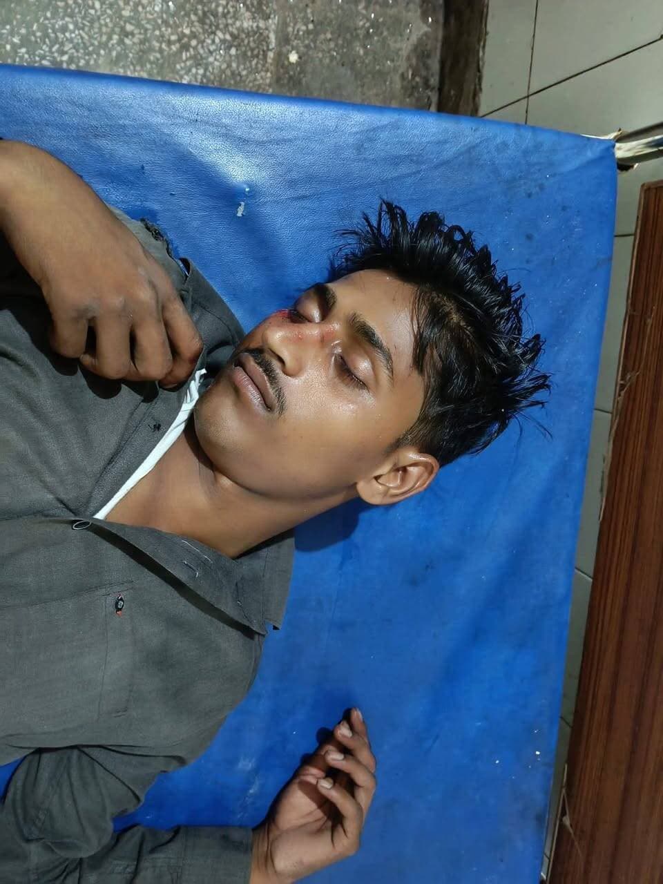 नवाबगंज-अचरा मार्ग पर बाइक सवार युवक घायल, एंबुलेंस से सीएचसी में भर्ती
नवाबगंज, फर्रुखाबाद। मेरापुर थाना क्षेत्र के रशूलपुर पिलखना गांव निवासी योगेंद्र सिंह पुत्र रमेश चंद सोमवार शाम मोटरसाइकिल से अपने घर लौट रहे थे। वह नवाबगंज में सोलर पैनल बदलवाने के लिए आए थे।
शाम करीब पांच बजे नवाबगंज-अचरा मार्ग पर पहुंचने के दौरान उनकी बाइक दुर्घटनाग्रस्त हो गई, जिससे योगेंद्र सिंह घायल हो गए।
घटना की सूचना मिलते ही एंबुलेंस मौके पर पहुंची और घायल युवक को उपचार के लिए नवाबगंज सामुदायिक स्वास्थ्य केंद्र में भर्ती कराया गया। फार्मासिस्ट सर्वेश श्रीवास्तव ने घायल का प्राथमिक उपचार किया।
घायल के पास मिले मोबाइल फोन से परिजनों को हादसे की सूचना दी गई। जानकारी मिलते ही परिजन सीएचसी पहुंचे और घायल का हालचाल जाना।
#FarrukhabadNews #Nawabganj #AccidentNews #RoadAccident #UPNews #BreakingNews #फर्रुखाबाद #नवाबगंज #सड़कहादसा #बाइकदुर्घटना #घायल #सीएचसी #बड़ीखबर