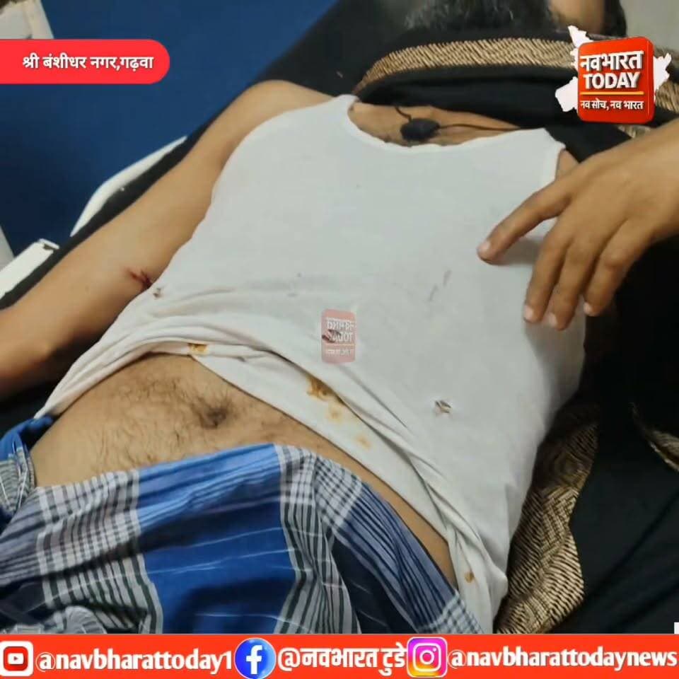 श्री बंशीधर नगर: धान के खेत में घास निकाल रहे किसान पर जंगली सुअरों का हमला, घायल
#nagaruntari #गढ़वा