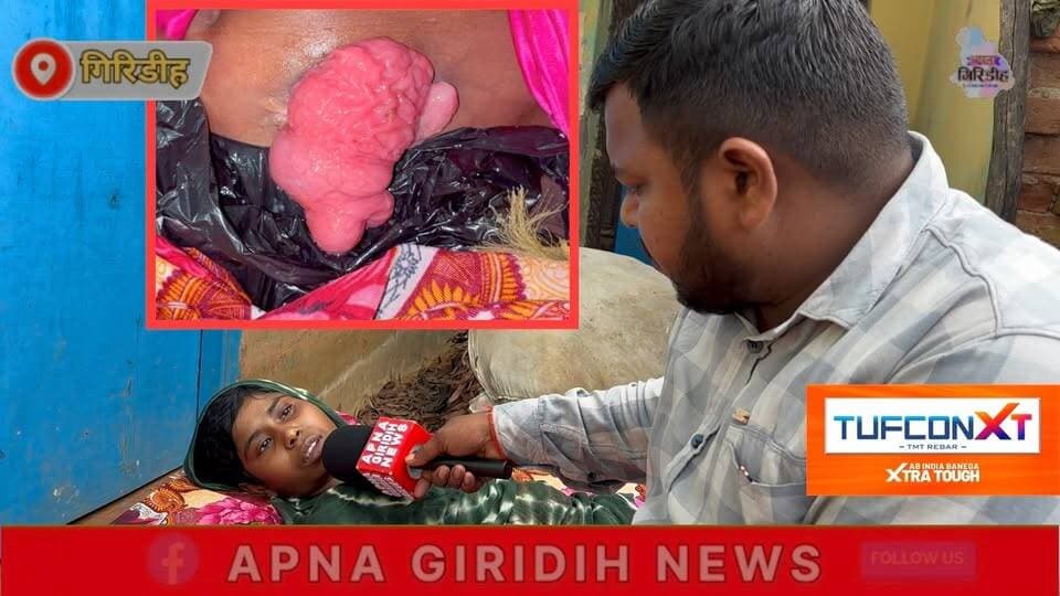 तीन साल से कैंसर से जूझ रही 20 वर्षीय संजू, इलाज के लिए मदद की आस। #apnagiridihnews #GiridihNews #CancerAwareness #HemantSoren
Hemant Soren DC Giridih @topfans