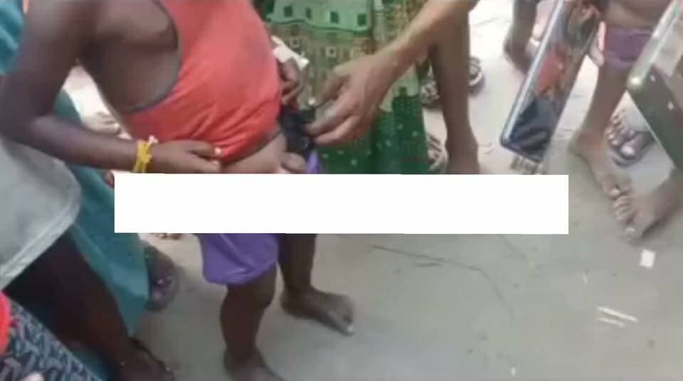 धौरहरा पुलिस की बर्बरता: मासूम बच्चों और बुजुर्ग महिलाओं को बेरहमी से पीटा, ग्रामीणों ने लगाए गंभीर आरोप
लखीमपुर खीरी जिले के धौरहरा थाना क्षेत्र अंतर्गत सिसैया खुर्द गांव से पुलिसिया बर्बरता का मामला सामने आया है। ग्रामीणों का आरोप है कि सोमवार की रात धौरहरा पुलिस ने गांव में घुसकर मासूम बच्चों और बुजुर्ग महिलाओं के साथ बर्बरता से मारपीट की।
विधायक व प्रधान के खिलाफ प्रदर्शन करने पर कार्रवाई का आरोप
पीड़ित ग्रामीणों के अनुसार, उनका कसूर सिर्फ इतना था कि उन्होंने दो दिन पूर्व धौरहरा विधायक और स्थानीय ग्राम प्रधान के खिलाफ अपना विरोध दर्ज कराया था। आरोप है कि इसी रंजिश के चलते पुलिस ने रात के अंधेरे में उन पर बर्बरतापूर्ण कार्रवाई की।
वीडियो वायरल होने से मचा हड़कंप
घटना से जुड़ा एक वीडियो भी सोशल मीडिया पर तेजी से वायरल हो रहा है। इस वीडियो में एक छोटा बच्चा और बुजुर्ग महिला पुलिस की पिटाई का दर्द बयां करते हुए नजर आ रहे हैं। वीडियो सामने आने के बाद इलाके में आक्रोश व्याप्त है।