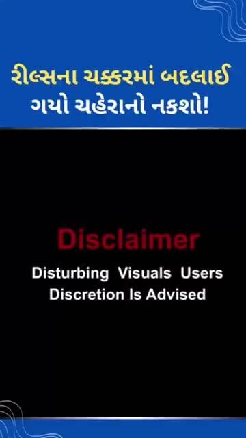 બદલાઈ ગયો ચહેરાનો નકશો #tejgujarati