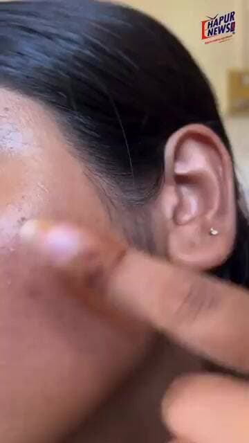 Clear Skin अब महंगी नहीं! पाएं फ्रेश और ग्लोइंग लुक, वो भी ₹299 से कम में!8395000141 | 9837142822