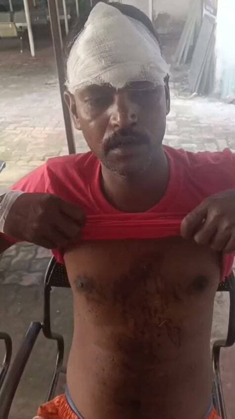 मारपीट में युवक गंभीर रूप से घायल, धारदार हथियार से हमला करने का आरोप
नवलशाही थाना क्षेत्र के बनयोंक गांव की घटना, पीड़ित का आरोप—थाना में आवेदन नहीं लिया गया
कोडरमा जिला के नवलशाही थाना क्षेत्र के बनयोंक गांव में मारपीट की घटना में शंकर साव, पिता चेतन साव गंभीर रूप से घायल हो गए। पीड़ित ने आरोप लगाया है कि सन्नू साव, पिता दाशी साव, दिवाकर, सन्नू साव की पत्नी तथा सन्नू साव के भांजे सूरज कुमार साव ने उसके साथ मारपीट की।
पीड़ित के अनुसार, मारपीट के दौरान नुकीले चाकू एवं टांगी से हमला किया गया, जिससे उसके माथे पर गंभीर चोट आई है। वहीं छाती पर भी धारदार हथियार से वार किए जाने का आरोप लगाया गया है। घटना के बाद घायल का इलाज कराया गया।
पीड़ित का आरोप है कि घटना को लेकर वह नवलशाही थाना में शिकायत दर्ज कराने पहुंचा, लेकिन उसका आवेदन नहीं लिया गया। पीड़ित ने मामले में कार्रवाई की मांग की है।
#SPkoderma
