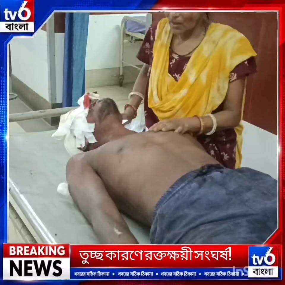 হাবড়ায় বিশ্বকর্মা পুজোয় ঘুড়ি ওড়ানোকে কেন্দ্র করে বচসা, ধারালো অস্ত্রের কোপে জখম যুবক
#tv6বাংলা #fpyシviralfypシ゚viralシalシ #reelsviralシ