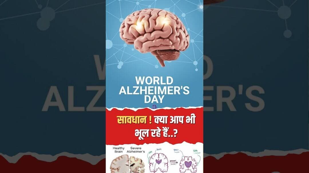 अपना नाम और चेहरा भूल जाना! जानिए Alzheimers का खौफनाक सच! #ytshorts