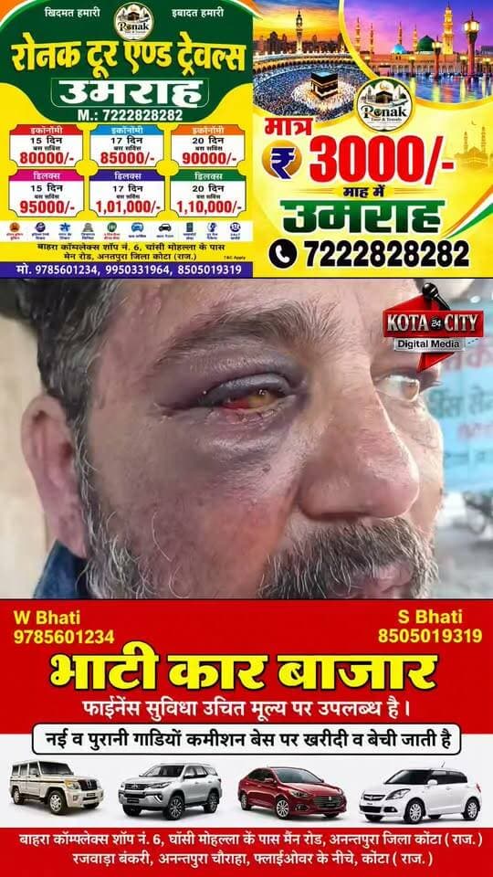 कोटा के उद्योग नगर थाना क्षेत्र में पुलिसकर्मी पर मारपीट के गंभीर आरोप लगे हैं। चंद्रशेखर कॉलोनी निवासी मजहर अली ने एसपी को शिकायत देकर एसआई केसरिया पर थाने ले जाकर मारपीट करने का आरोप लगाया है। मजहर अली के मुताबिक 19 सितंबर की शाम करीब 7 बजे वह कंसुआ से अपने घर लौट रहे थे, इसी दौरान चंद्रशेखर कॉलोनी के बाहर मेन रोड पर भीड़ देखकर वह रुक गए। आरोप है कि वहां मौजूद एसआई ने उनसे रुकने का कारण पूछा और नेतागिरी करने की बात कही। मजहर का कहना है कि उन्होंने केवल भीड़ देखने के लिए रुकने की बात कही, जिसके बाद उनके साथ मारपीट की गई और उन्हें थाने ले जाया गया, जहां लात-घूंसों से पीटने का आरोप है। पीड़ित के अनुसार मारपीट में उनकी आंख, सिर, हाथ, पैर और गर्दन पर चोटें आई हैं। उन्होंने मामले की निष्पक्ष जांच, मेडिकल करवाने, मुकदमा दर्ज करने और दोषियों के खिलाफ कार्रवाई की मांग की है।