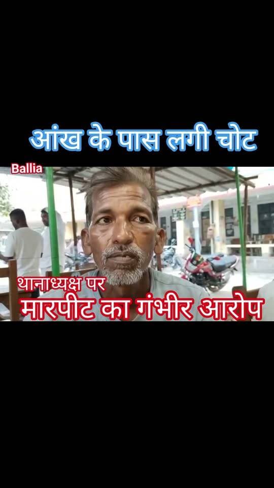 #बलिया #बेल्थरारोड #एसडीएम कोर्ट से जमानत मिलते ही सामने आया थाने में कथित मारपीट का मामला: भीमपुरा #थानाध्यक्ष पर पीड़ित हंसनाथ ने लगाया गंभीर आरोप, कहा- भूमि विवाद में थाने बुलाकर की गई पिटाई, आंख के पास आई चोट, एसपी से कार्रवाई और न्याय की लगाई गुहार, जबकि #पुलिस ने दोनों पक्षों के छह लोगों का शांति भंग की आशंका में किया था चालान।
#followerseveryone #fb #nonfollowersviewers #viral
#BalliaNews
#BeltharaRoad
#BhimpuraPolice
#UttarPradeshNews
#PoliceAction