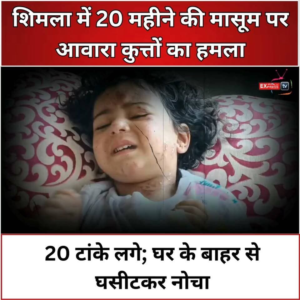 शिमला में 20 महीने की मासूम पर आवारा कुत्तों का हमला, 20 टांके लगे; घर के बाहर से घसीटकर नोचा
शिमला के शांकली क्षेत्र में आवारा कुत्तों के हमले से हड़कंप मच गया। दो कुत्तों ने 20 महीने की बच्ची को घर के बाहर से घसीटकर करीब 20 से 30 मीटर दूर ले जाकर बुरी तरह नोच डाला। चीखें सुनकर मां और स्थानीय लोगों ने किसी तरह बच्ची को कुत्तों से छुड़ाया। बच्ची को IGMC में भर्ती कराया गया, जहां उसके शरीर पर करीब 20 टांके लगाए गए। मामले के बाद परिजनों ने प्रशासन से खतरनाक आवारा कुत्तों पर प्रभावी कार्रवाई की मांग की है।
#Shimla #ShimlaNews #StrayDogs #DogAttack #HimachalNews #IGMCShimla #BreakingNews #शिमला #आवाराकुत्ते #कुत्तोंकाहमला #हिमाचलप्रदेश #चंबाएक्सप्रेस