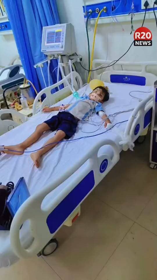 सम्भल जिला अस्पताल से सामने आया हैरान करने वाला मामला। परिजनों का आरोप है कि चार वर्षीय मासूम को सांप ने काटा, लेकिन अस्पताल में एंटीवेनम देने के बजाय एंटी रेबीज और पीसीएम दवा देकर घर भेज दिया गया।
परिजनों और स्नेकर जाबुल का दावा है कि बच्चे को खतरनाक कॉमन क्रेट सांप ने काटा था। हालत बिगड़ने पर मासूम को निजी अस्पताल में भर्ती कराया गया, जहां उसे वेंटिलेटर पर रखा गया है।
अब परिजन पूरे मामले में जांच और कार्रवाई की मांग कर रहे हैं। सवाल है—अगर समय रहते सही इलाज मिलता, तो क्या मासूम की हालत इतनी गंभीर होती?
R20 परिवार ईश्वर से मासूम के जल्द स्वस्थ होने की कामना करता है 🙏