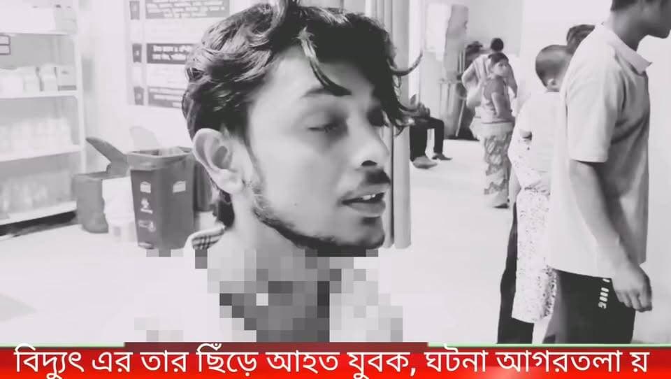 বিদ্যুতের তার চিরে গলায় পেঁচিয়ে আহত অমিত আচার্জী নামে এক যুবক। ঘটনা আগরতলা মোটর স্ট্যান্ড থানা এলাকায়।
#newsgupdate #foryouシ #engagement #nonfollowers