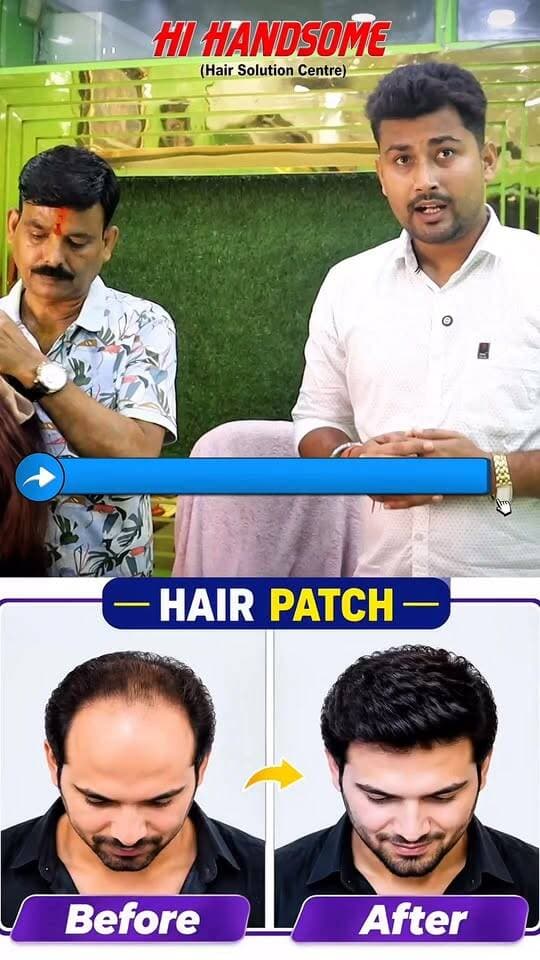 गंजेपन का परमानेंट और सस्ता इलाज! Hi Handsome के साथ!
#hairpatchindia #HairPatchTransformation #hairwigformen #lowcosthairwig #thepublicpoints