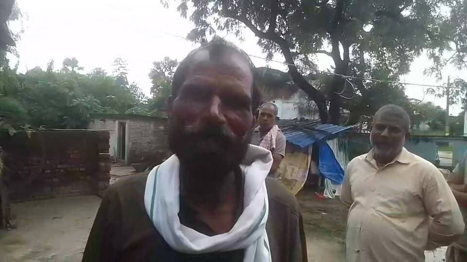 वासुदेव यादव के घर पहुंचे रमेश चंद यादव
“बेलघाट में पार्टी नहीं, आरी का लिया था सहारा; पांच साल साइकिल का सहारा… अब फिर चुनावी तैयारी, जनता पूछ रही—विकास की बारी कब?”
मृत भोज-बारात में खूब झूमे;
विकास का जब पूछा हिसाब,
बजट के नाम पर चुपके से घूमे!”