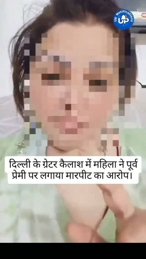 News Update - दिल्ली के ग्रेटर कैलाश में एक महिला ने अपने पूर्व प्रेमी पर ब्रेकअप के बाद गंभीर मारपीट का आरोप लगाया है। महिला ने सीआर पार्क पुलिस स्टेशन में लिखित शिकायत दर्ज कराई है। परिवार को धमकियां भी मिली हैं और आरोपी के पिता जम्मू-कश्मीर में आईएएस अधिकारी बताए जा रहे हैं।
#DelhiNews #GreaterKailash #WomensSafety #DelhiPolice #NewsUpdate
DISCLAIMER
This video is intended for news and informational purposes only. It does not promote, support, or encourage any form of violence, hatred, or illegal activity. The content is presented solely to inform the public. Viewer discretion is advised.