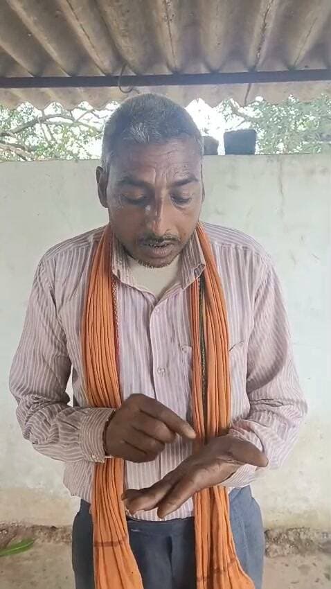 बिजली विभाग का गजब कारनामा!दो कमरे के घर में पति पत्नी के अलग अलग कनेक्शन,
कनेक्शन बंद करने आवेदन के बाद भी नहीं काटे कनेक्शन, अब बिल और नोटिस से परेशान गरीब परिवार,
सीधी/सेमरिया। सेमरिया वितरण केंद्र अंतर्गत ग्राम पंचायत ऐंठी के वार्ड क्रमांक 7 में बिजली कनेक्शन और बकाया बिल को लेकर एक गरीब परिवार विद्युत विभाग की कार्रवाई से परेशान है। परिवार का कहना है कि दो कमरों के मकान में पति-पत्नी के नाम पर दो बिजली कनेक्शन दर्ज हैं। परिवार ने अतिरिक्त कनेक्शन बंद करने के लिए विभाग में आवेदन भी दिया, लेकिन उसके बाद भी कनेक्शन बंद नहीं किया गया और बिल लगातार सामने आते रहे। अब बकाया राशि को लेकर नोटिस मिलने से परिवार की परेशानी और बढ़ गई है।
कनेक्शन बंद करने के लिए दिया था आवेदन
परिवार के अनुसार, जब उन्हें पता चला कि एक ही मकान में पति-पत्नी के नाम पर अलग-अलग बिजली कनेक्शन दर्ज हैं, तो उन्होंने संबंधित विद्युत विभाग के अधिकारियों से संपर्क कर एक कनेक्शन बंद करने का अनुरोध किया और आवेदन सौंपा।
परिवार का कहना है कि विभाग को कनेक्शन बंद करने की जानकारी देने के बावजूद संबंधित कनेक्शन बंद नहीं किया गया। इसके बाद भी बिल आते रहे। परिवार का सवाल है कि जब कनेक्शन बंद करने के लिए विभाग को पहले ही आवेदन दिया जा चुका था, तो उसके बाद उत्पन्न हुई बिलिंग की जिम्मेदारी और वास्तविक देय राशि की स्थिति क्या है?
मोबाइल पर SMS आते रहे, परिवार नहीं समझ पाया
परिवार के अनुसार, बिजली विभाग द्वारा बिल संबंधी जानकारी मोबाइल पर SMS के माध्यम से भेजी जाती रही। परिवार के सदस्य अधिक पढ़े-लिखे नहीं होने के कारण इन संदेशों में दी गई जानकारी और अलग-अलग कनेक्शनों की बिलिंग को पूरी तरह समझ नहीं सके।
अब विभाग की ओर से बकाया राशि को लेकर नोटिस पहुंचने के बाद परिवार को मामले की गंभीरता का पता चला। परिवार का कहना है कि वह आर्थिक रूप से कमजोर है और विभागीय नोटिस की कार्रवाई को लेकर काफी परेशान है।
₹3,176 और ₹20,788 की बकाया राशि के दस्तावेज
परिवार द्वारा उपलब्ध कराए गए दस्तावेजों में एक कनेक्शन पर ₹3,176 की लंबित बकाया राशि का अंतिम नोटिस जारी होना बताया गया है। वहीं एक अन्य दस्तावेज में ₹20,788 की बकाया राशि का उल्लेख करते हुए वसूली संबंधी कार्रवाई की सूचना दी गई है।
परिवार का कहना है कि दोनों कनेक्शनों और बकाया राशि का विभागीय रिकॉर्ड सामने रखकर स्पष्ट किया जाए कि किस कनेक्शन की कितनी वास्तविक देनदारी है और कनेक्शन बंद करने के आवेदन के बाद भी बिल किस आधार पर जारी होते रहे।
परिवार का आरोप—समाधान की जगह बढ़ती गई परेशानी
रामबहादुर प्रजापति का कहना है कि परिवार ने विवाद बढ़ाने के बजाय विभाग से समस्या का समाधान कराने का प्रयास किया। संबंधित कर्मचारियों और अधिकारियों को जानकारी देने के साथ कनेक्शन बंद करने का आवेदन भी दिया गया, लेकिन समस्या का समाधान नहीं हुआ।
परिवार का आरोप है कि कनेक्शन बंद करने के अनुरोध के बावजूद बिल जारी होते रहे और अब नोटिस भेजकर गरीब एवं बेबस परिवार पर कार्रवाई का दबाव बनाया जा रहा है। परिवार चाहता है कि विभाग पहले पूरे मामले की निष्पक्ष जांच करे और उसके बाद ही बकाया राशि के संबंध में कोई कार्रवाई की जाए।
विभाग से जांच और रिकॉर्ड सार्वजनिक करने की मांग
परिवार ने विद्युत विभाग के वरिष्ठ अधिकारियों से मांग की है कि मौके पर पहुंचकर दोनों मीटरों की जांच की जाए तथा कनेक्शन आवेदन, कनेक्शन स्वीकृति, मीटर रीडिंग, बिलिंग रिकॉर्ड, कनेक्शन बंद करने के लिए दिए गए आवेदन और वर्तमान बकाया राशि का सत्यापन किया जाए।
परिवार का कहना है कि यदि दोनों कनेक्शन नियमानुसार स्वीकृत हैं तो इसकी स्पष्ट जानकारी दी जाए और यदि कोई कनेक्शन अनावश्यक या गलत तरीके से दर्ज है तो नियमानुसार उसे बंद कर बिलिंग संबंधी समस्या का निराकरण किया जाए।
अब सवाल यह है कि कनेक्शन बंद करने के लिए आवेदन दिए जाने के बावजूद संबंधित कनेक्शन क्यों जारी रहा और उसके बाद की बिलिंग किस आधार पर हुई? इन सवालों का जवाब विभागीय जांच और रिकॉर्ड सामने आने के बाद ही स्पष्ट होगा।
परिवार ने वरिष्ठ अधिकारियों से मामले में जल्द जांच कर राहत देने की मांग की है।
बयान
"राजेश पांडेय प्रभारी अधिकारी विद्युत वितरण केंद्र सेमरिया जिला सीधी,
हमे सेमरिया में आए हुए डेढ़ महीने हुए हैं हमे ये जानकारी आपके प्राइड कदम समाचार सीधी के माध्यम से प्राप्त हो रही है हम जल्द ही संबंधित मामले की विधिवत जांच कर कनेक्शन विच्छेद कर उपभोक्ता को न्याय देने का प्रयास करेंगे,साथ ही ये त्रुटि कैसे हुई उसकी भी जांच करेंगे
