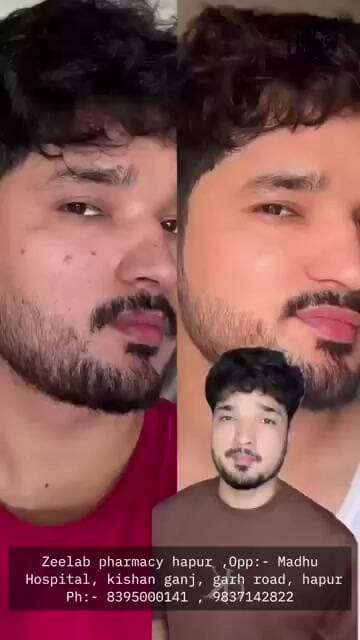 ✨ **Clear Skin अब महंगी नहीं!** ✨पाएं फ्रेश और ग्लोइंग लुक, वो भी ₹149 से कम में