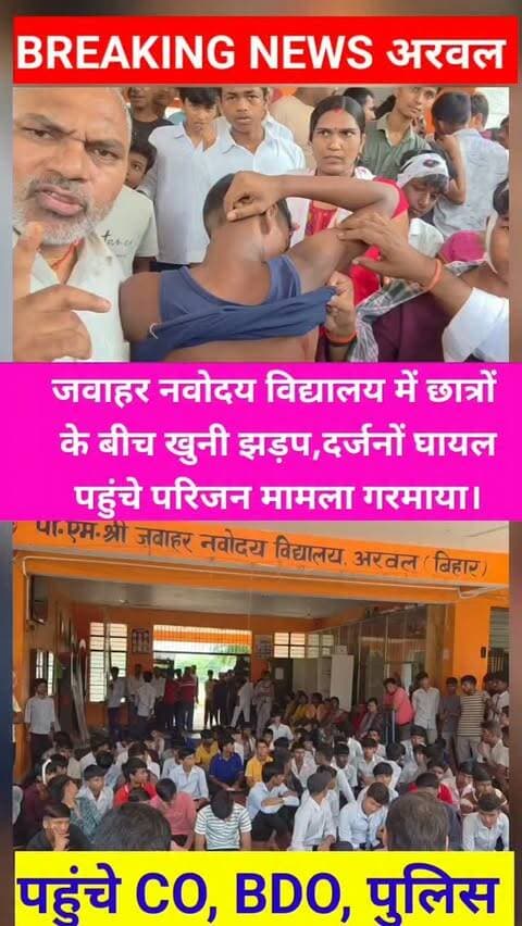 अरवल में जवाहर नवोदय विद्यालय में छात्रों के बीच खूनी झड़प, दर्जनों घायल, परिजन पहुंचे तो गरमाया मामला
#ArwalNews #Arwal #JawaharNavodayaVidyalaya #NavodayaVidyalaya #StudentFight SchoolNews EducationNews SchoolAdministration EducationDepartment SchoolManagement StudentSafety CampusSafety ArwalAdministration DMArwal EducationDepartmentBihar BiharNews BiharEducation BreakingNews ViralNews LatestNews GroundReport