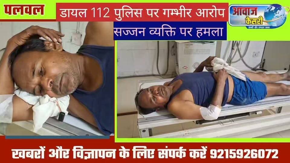 पलवल के चांदहट गांव में डायल 112 पुलिस की बर्बरता आई सामने। घर के पास खड़े व्यक्ति पर जानलेवा हमला। घायल का आज नागरिक अस्प्ताल में कराया गया ईलाज।
