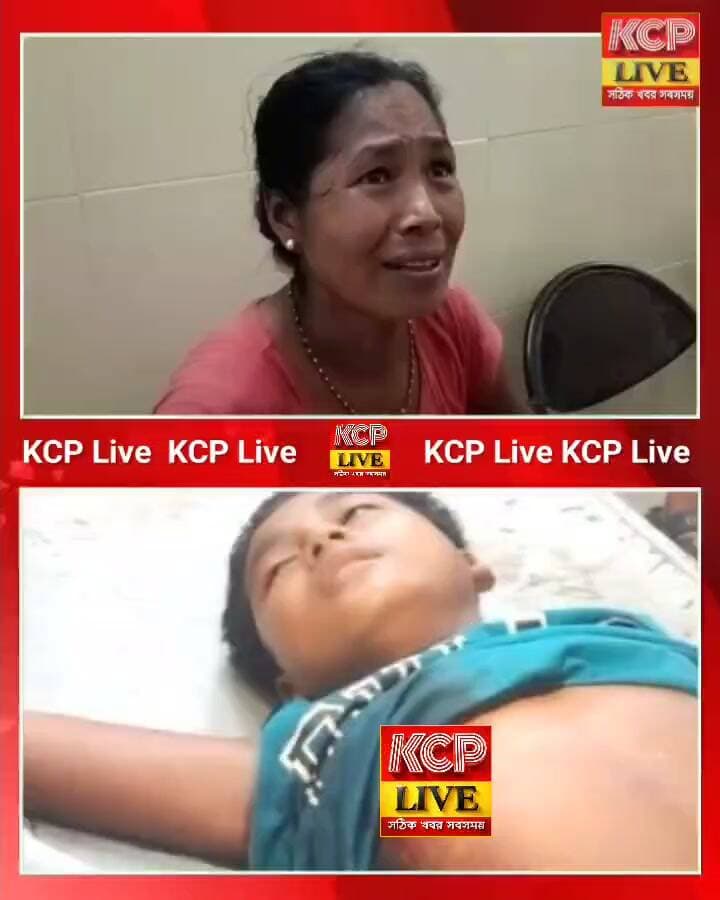রহস্যজনকভাবে গুলিবিদ্ধ সপ্তম শ্রেণির ছাত্র। ঘটনা উদয়পুরের নতুনবাজার থানাধীন রামভদ্র এলাকায়!আহতের নাম মারহেন রিয়াং!
রিপোর্ট। গোপাল সিং। ত্রিপুরা
করবুক মহকুমায় গুলি চালানোর ঘটনায় ১৪ বছরের কিশোর আহত।করবুক মহকুমার বিসিংগো রামবদ্রা কামি ও চুরাই এলাকায় মোবাইল সংক্রান্ত বিষয়কে কেন্দ্র করে গুলি চালানোর ঘটনা ঘটেছে বলে বিশ্বস্ত সূত্রের খবর।ঘটনায় মরহেন রিয়াং (১৪) নামে এক কিশোর আহত হয়েছে। সে হরেন্দ্র রিয়াং-এর ছেলে এবং বিরাজয় পাড়া এলাকার বাসিন্দা।
#dharmanagar #bigbreakingnews #kamalpur #kanchanpur #panisagar #Kadamtala #kailashahar #churaibari #BreakingNews #khowai #agartala #tripura