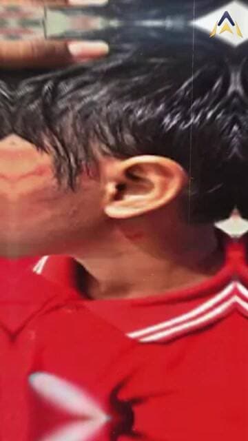 Homework नहीं किया तो टीचर ने जड़े कई थप्पड़; Bhopal में 5वीं के छात्र से Coaching में मारपीट!