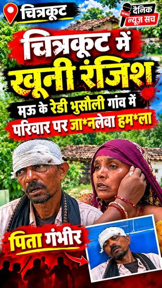चित्रकूट में खू*नी रंजिश: मऊ के रेडी भुसौली गांव में परिवार पर जा*नलेवा हम*ला, पिता गंभीर
#dainiknewssach #viralvideo #trendingreels #shorts #चित्रकूट