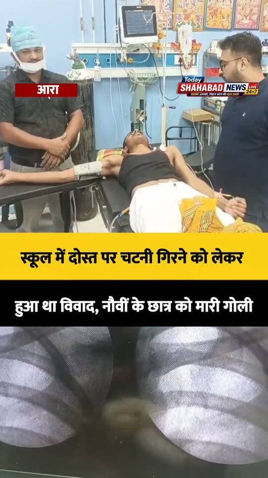 स्कूल में दोस्त पर चटनी गिरने को लेकर हुआ था विवाद, नौवीं के छात्र को मारी गोली