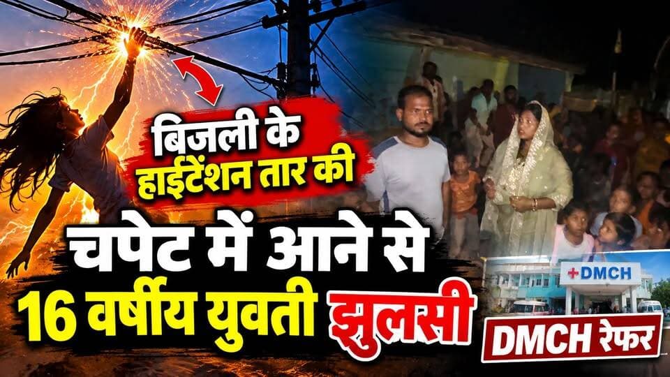 बिजली के हाईटेंशन तार की चपेट में आने से 16 वर्षीय युवती झु'लसी, DMCH रेफर