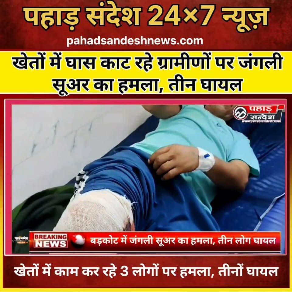 खेतों में घास काट रहे ग्रामीणों पर जंगली सूअर का हमला, तीन घायल ...
#BarkotNews #UttarkashiNews #WildBoarAttack #WildBoar #ThreePeopleInjured #UttarakhandNews #BreakingNews #Barkot #GairBanal #ForestDepartment #WildlifeAttack #RuralSafety #PahadSandesh #PahadSandeshNews
