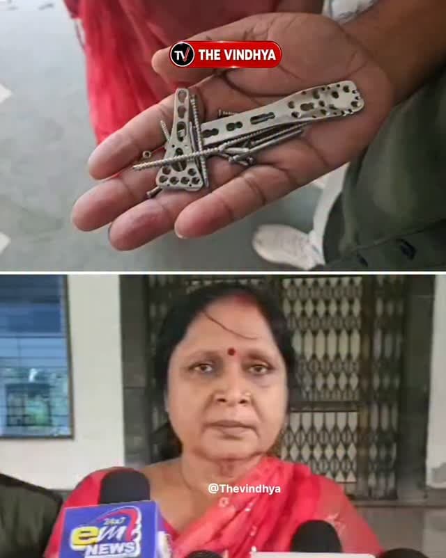 रीवा में महिला की संदिग्ध परिस्थितियों में मौत, पहले अस्पताल के इलाज पर उठाए थे सवाल
मध्य प्रदेश के रीवा के बोदाबाग क्षेत्र में रहने वाली मिथिलेश सिंह की आग में झुलसने से मौत हो गई। महिला ने पूर्व में संजय गांधी स्मृति चिकित्सालय में कंधे के ऑपरेशन के बाद कथित गलत इलाज और असहनीय दर्द की शिकायत की थी। उन्होंने संबंधित चिकित्सक डॉ. शुभम मिश्रा पर पैसे मांगने का आरोप लगाते हुए कलेक्टर से शिकायत भी की थी। इन आरोपों की स्वतंत्र पुष्टि नहीं हुई है। बताया जा रहा है कि परिजनों ने शव लेने से इनकार किया है। फिलहाल, मौत के कारणों का खुलासा पुलिस जांच के बाद ही हो सकेगा।
#RewaNews #WomanDeath #SanjayGandhiHospital #PoliceInvestigation #MadhyaPradeshNews